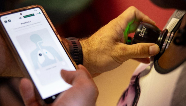 Over 100 Residents Receive AI-Powered TB Screening at Cape Town Health Day